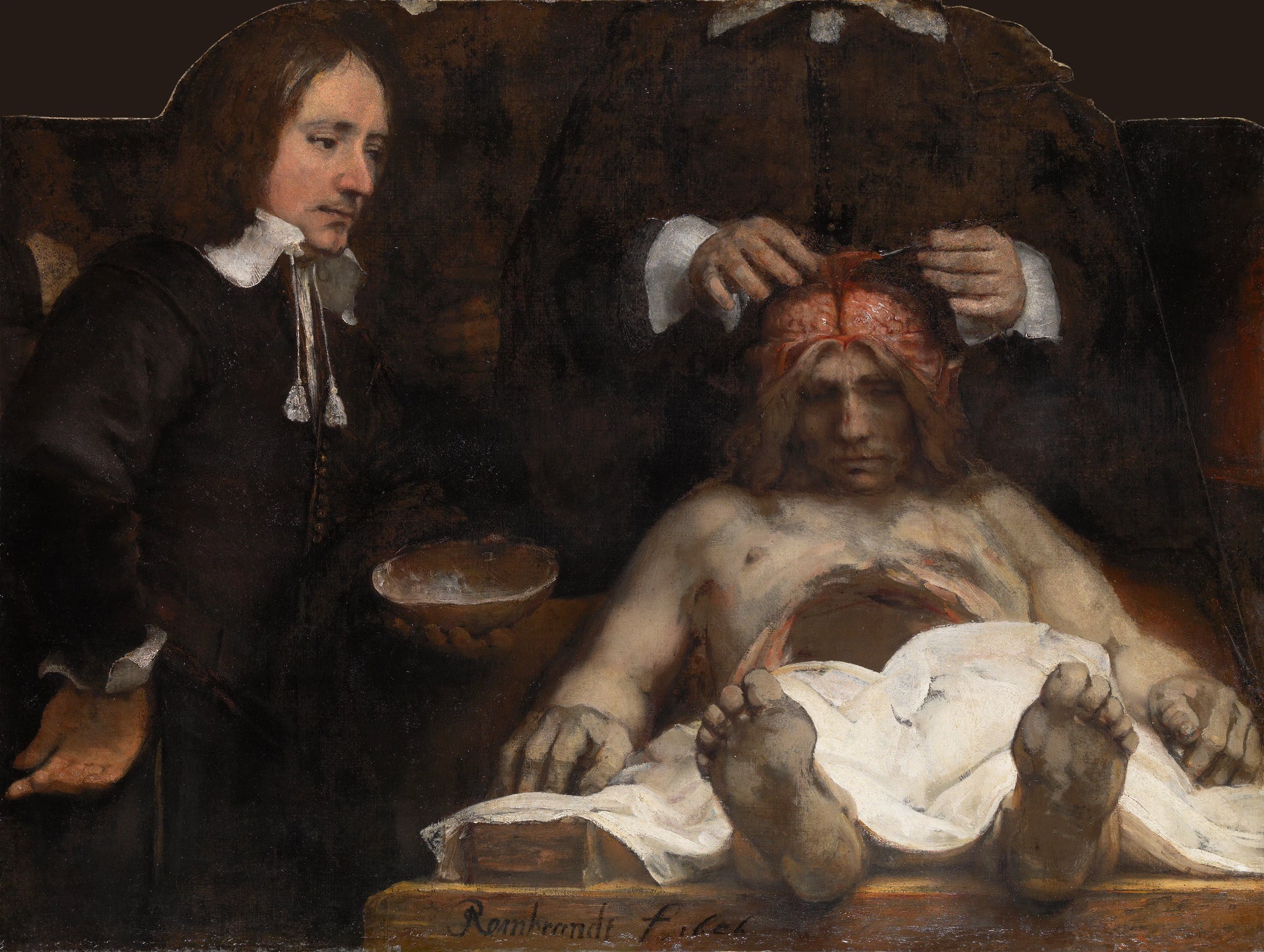 Leçon d'anatomie du Dr Jan Deijman - Rembrandt